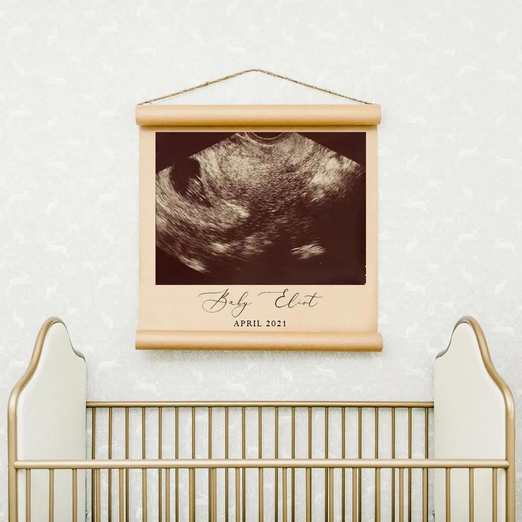 Custom Ultrasound Scroll