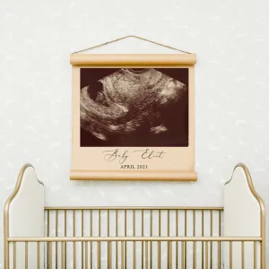 Custom Ultrasound Scroll